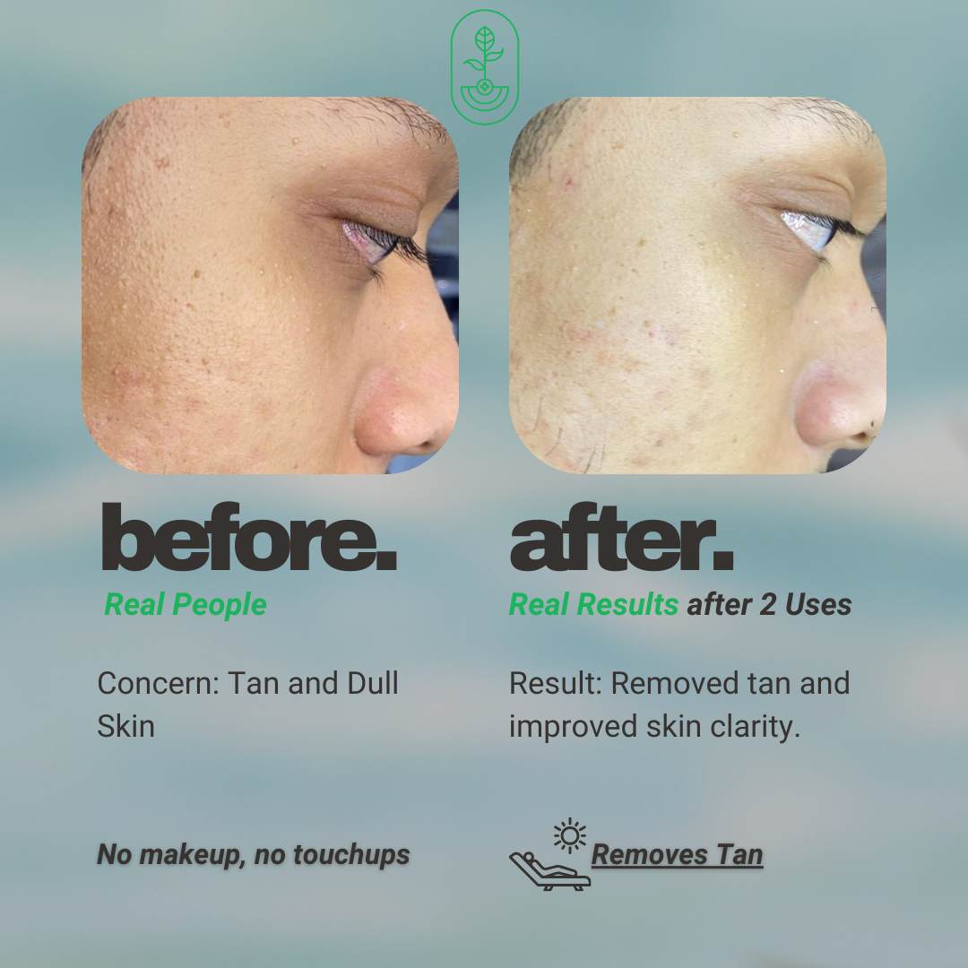 Before and after image showing the results of using Otanics De-Tan Face Pack. The left side shows the 'before' image with visible tan and dull skin, while the right side shows the 'after' image, showcasing removed tan and improved skin clarity after just 2 uses. Both images highlight that no makeup or touchups were used. Text emphasizes the skin concern and the product's effectiveness in removing tan and improving skin clarity.